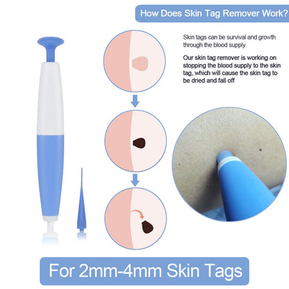 Skin Tag Removal Kit